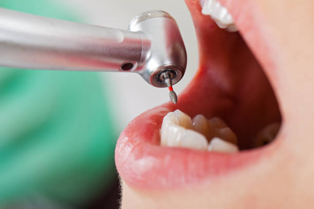 Best Cosmetic Emergency Dentistry in San Pablo, CA